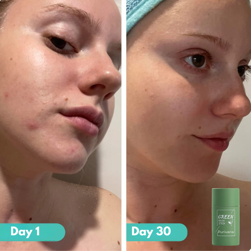 Purivana™ Green Mask Stick
