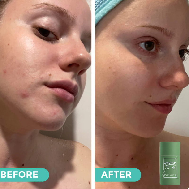 Purivana™ Green Mask Stick