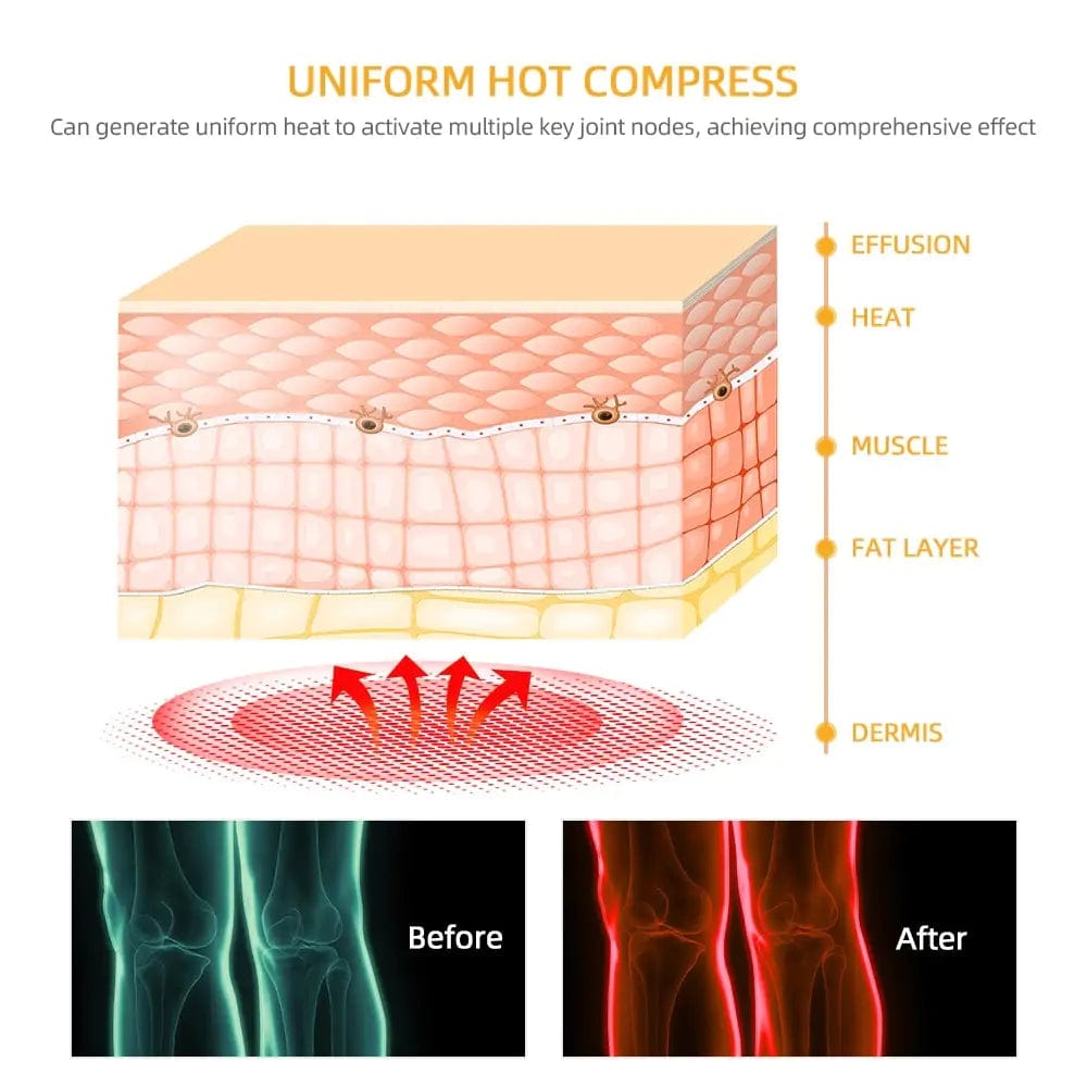 Flexora™ Wireless Knee Massager